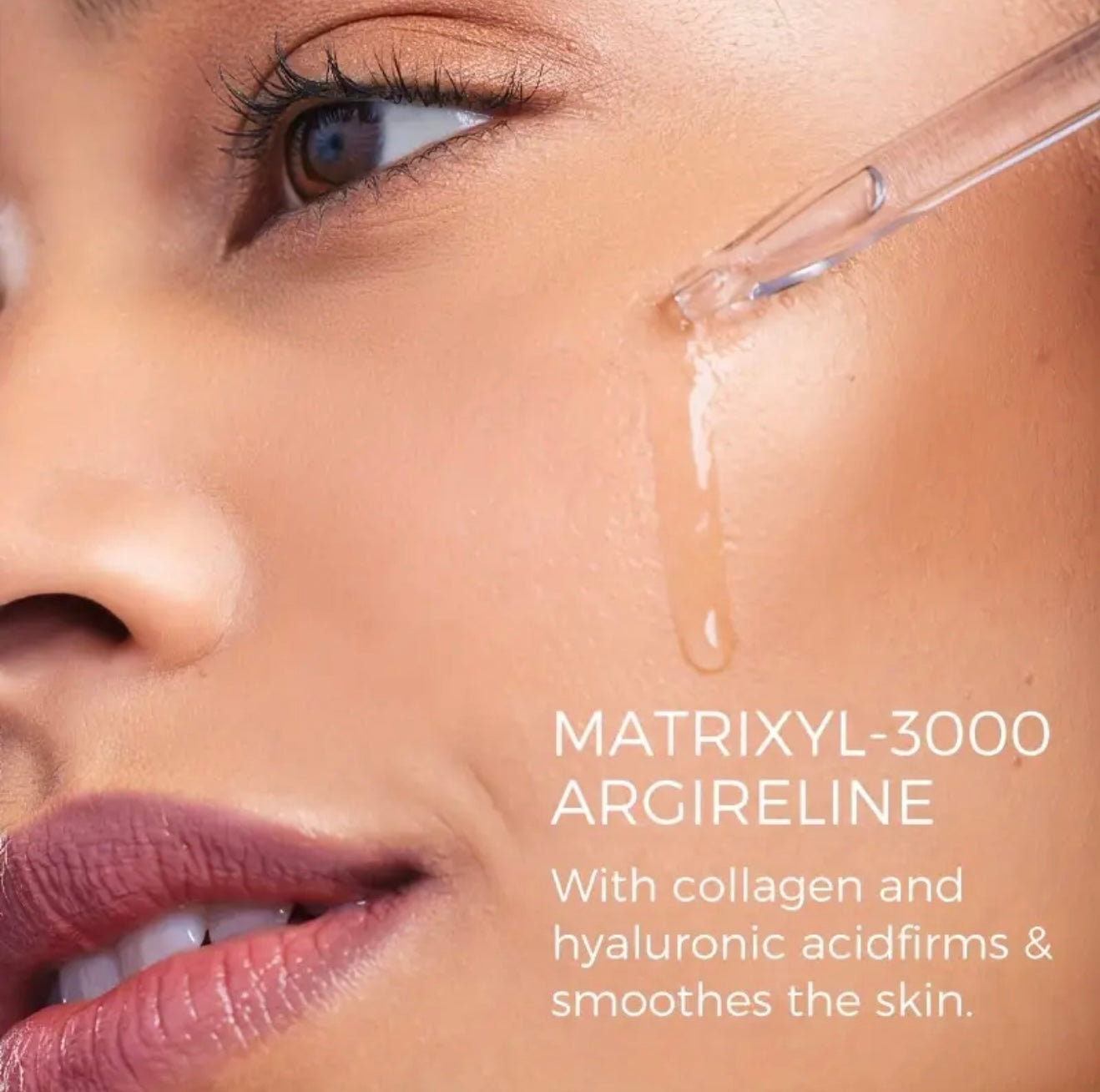 Matrixyl 3000